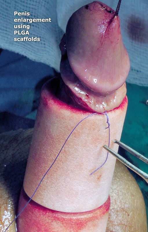 Penis Enlargement Clinic 88