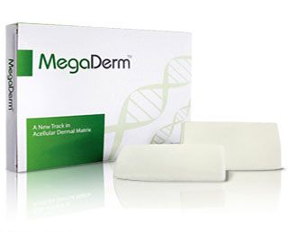 Dr. Kim promotes MegaDerm Allograft for Penis Enlargement.