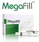 Ultimate Penis Enlargement using MegaFill