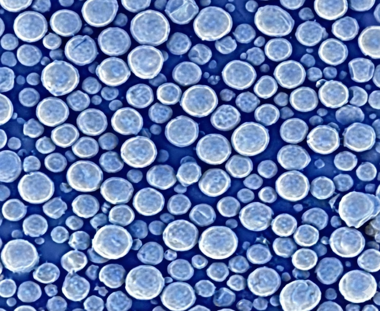 Use only safe and time tested materials for penile girth enhancement: Specialized Hyaluronic Acid or MegaFill